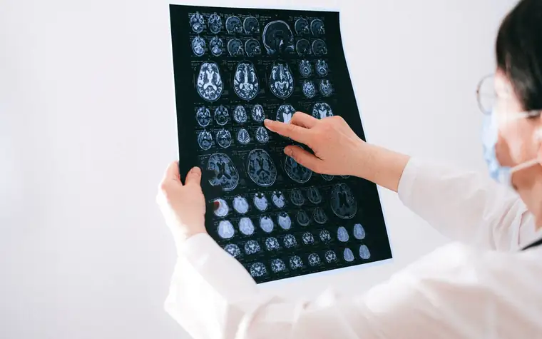 Pace of Alzheimer's progression related image 1