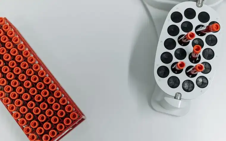 Top view of blood test tubes sitting in a centrifuge