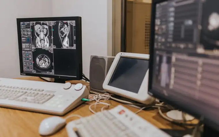 CT·MRI 영상이 떠 있는 판독실 모니터와 키보드
